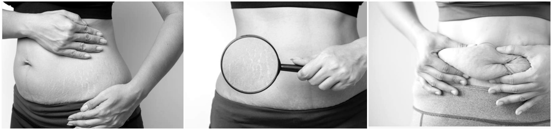 corps post partum après grossesse