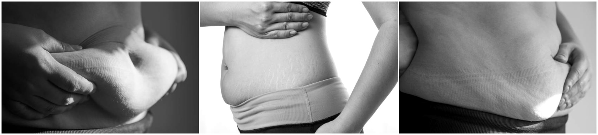 post partum corps